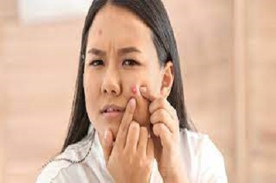 چه صابون هایی برای از بین بردن جوش مناسب است؟